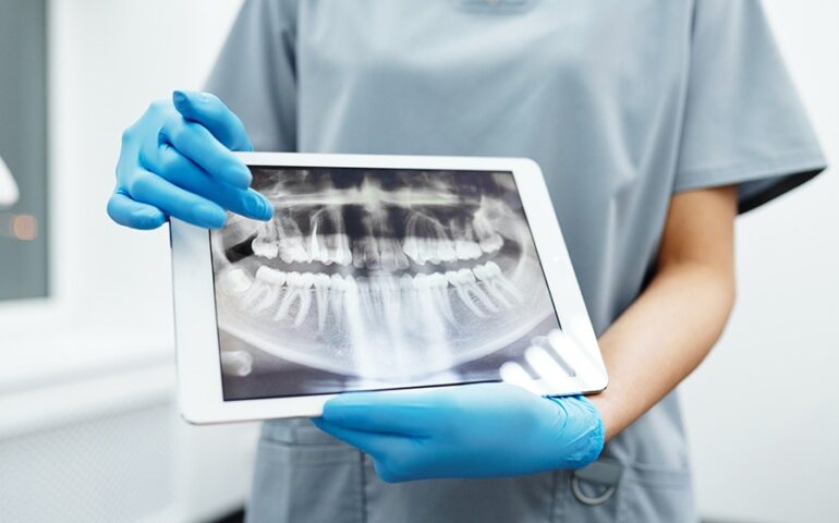 corona-dentis-zobozdravstvena-ambulanta-zobozdravnik-maribor-nasveti-04-900x600