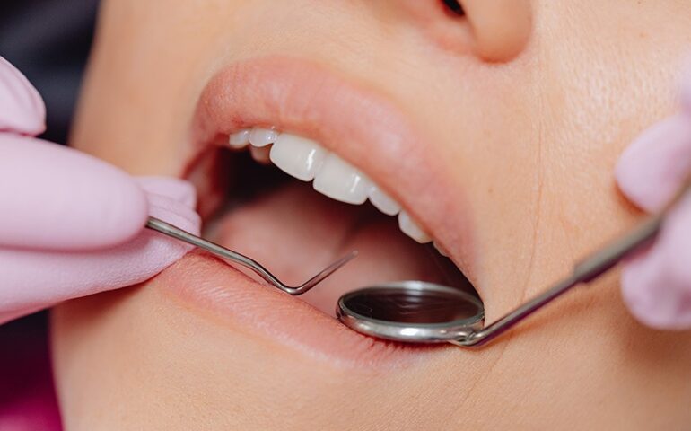 corona-dentis-zobozdravstvena-ambulanta-zobozdravnik-maribor-nasveti-14-900x600